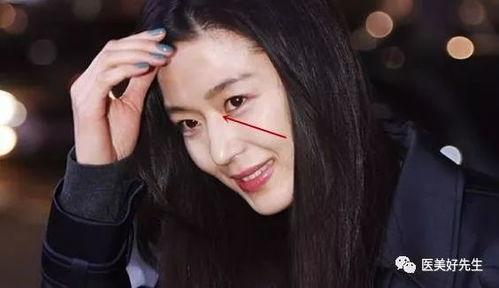 隆过鼻的女明星,揭秘隆鼻女明星的华丽转身